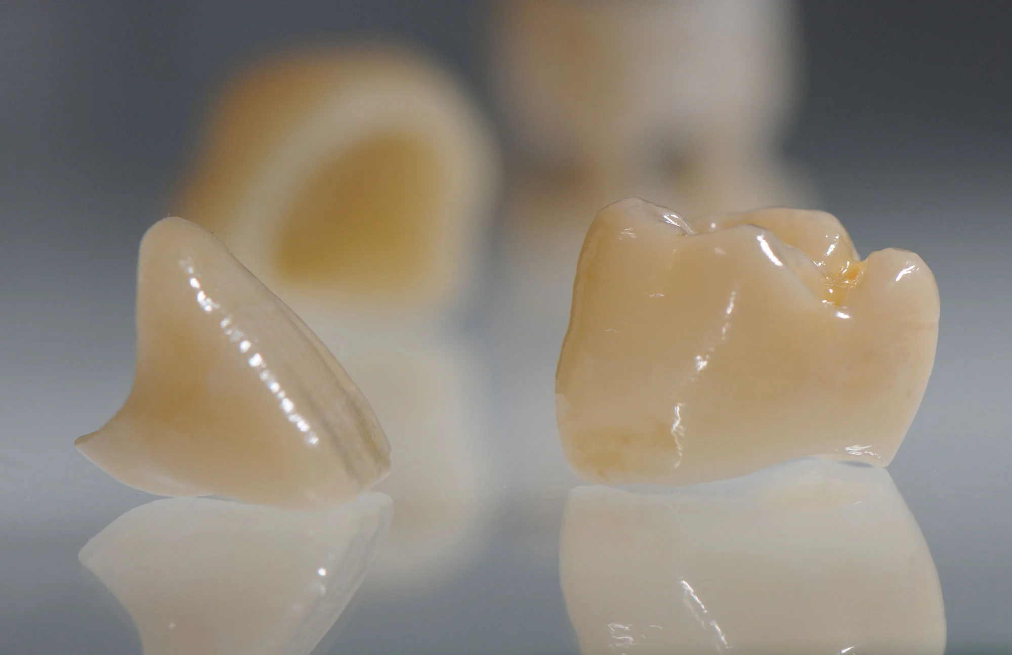 Macro photograph of a 3D-printed dental crown
