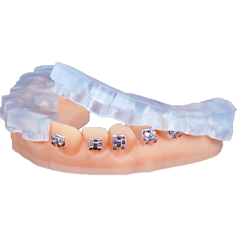 Orthodontic & Splints