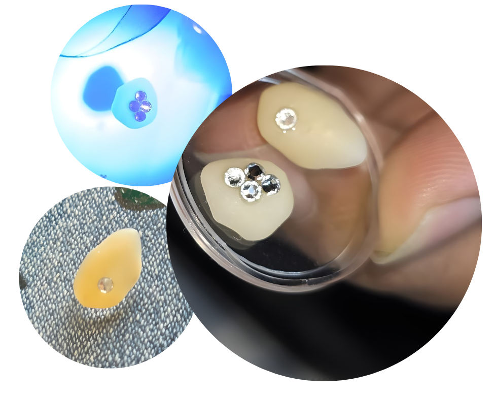 Diamond-Embedded Slip-on Veneers